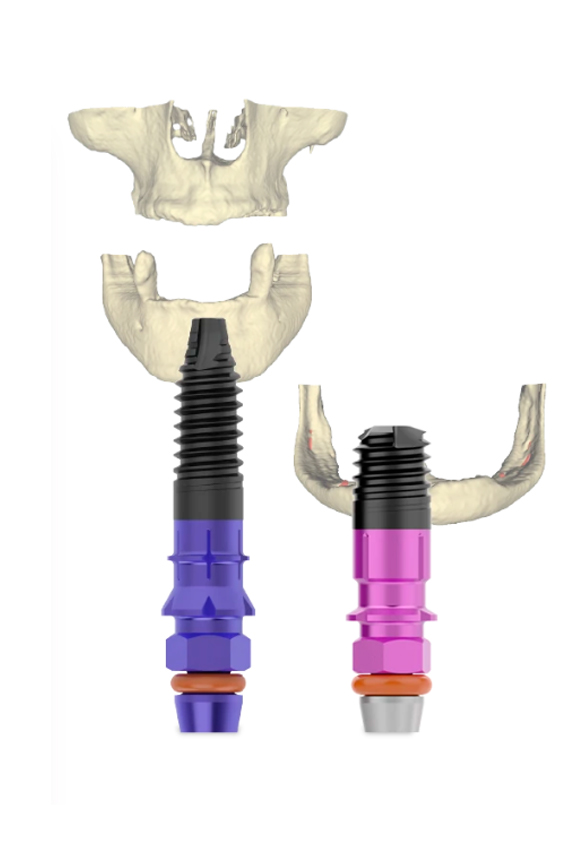 implante-dental-interior